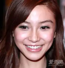 林心如高圆圆也丑过曾被一口烂牙毁容的女星