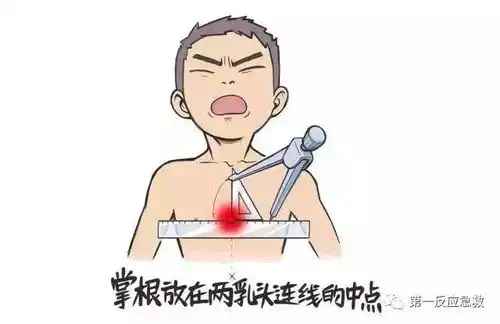 人工呼吸的表情包按压
