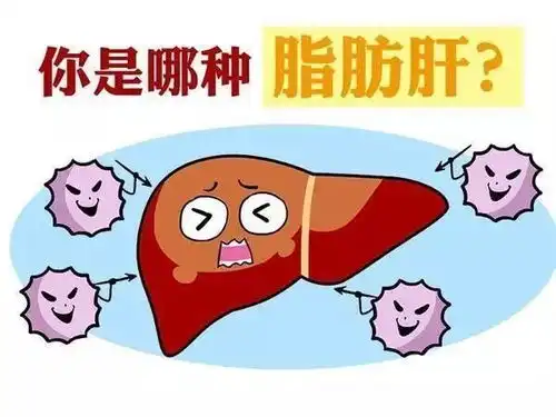 脂肪肝到底是怎么引发的该如何预防和根治