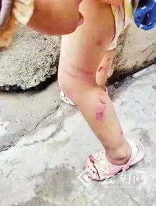 云南一男子晒毒打亲儿照片,称希望前妻看到能回来