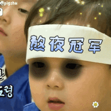 太尴尬拉低颜值的黑眼圈还分类