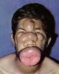 世界上最丑的男人,亚洲最少,非洲夺冠