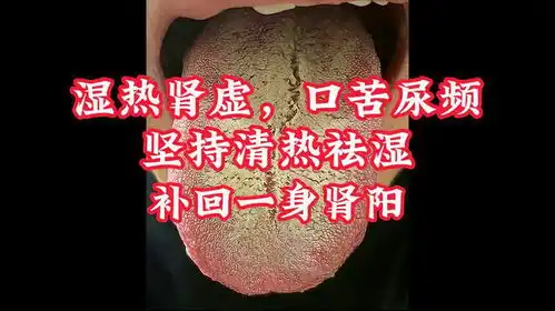 湿热肾虚,口苦尿频,坚持清热祛湿补回一身肾阳
