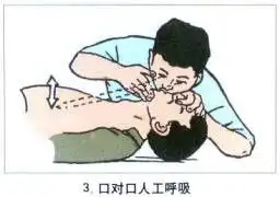 学会这个急救知识,说不定哪天能救人一命