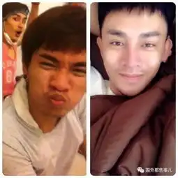 男子因太丑找不到女朋友整容30次后却常被搭讪