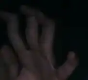 我的手指可以在第个1关节弯成差不多九十度,为什么别人不可以是不是有病