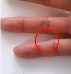 注意了这样玩手机会导致你的手指变弯