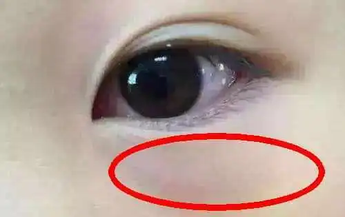 五种表现都提示宝宝脾胃比较虚弱,中两条,宝妈就要注意了