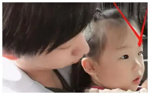 伊能静晒女儿小米粒照片,眼睛被网友指出问题赶紧送医院检查
