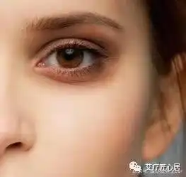 别问眼袋有多深,先看脾虚有几分艾灸除眼袋,效比整容