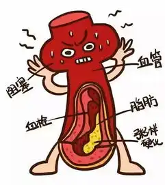 服用阿司匹林预防心血管疾病的发生没益处听听权威专家如何说
