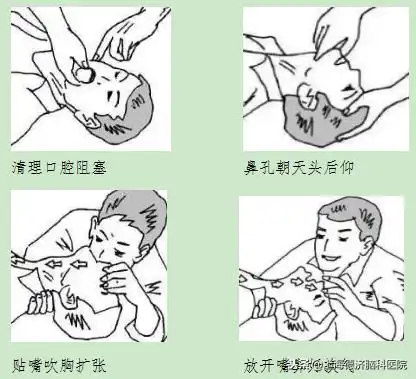 国民老公宋仲基在人工呼吸时错大了