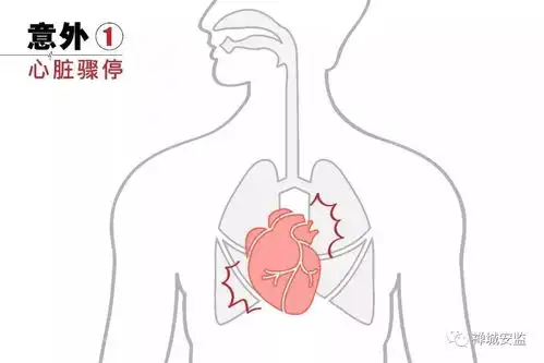 保命帖学会这5个保命技巧,生死关头,救你一命