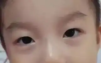 如果宝宝手脚出现这种状况,一定要警惕