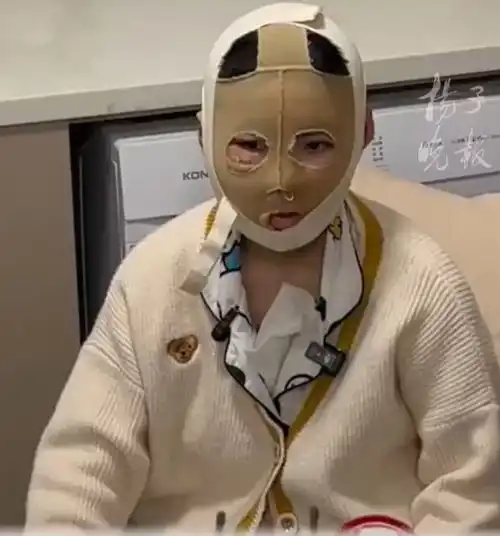 最新后续27岁女孩被前男友烧伤,希望二审重判女孩发声