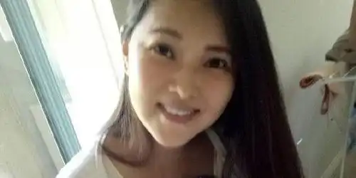 伊能静图片表情包伤口感
