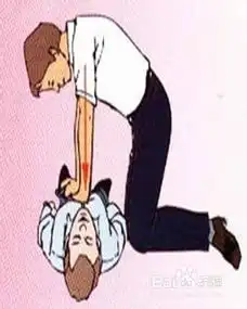 如何进行心肺复苏术