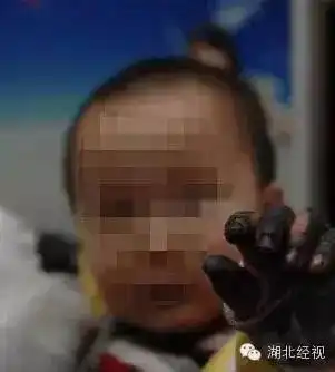 电动车这个部位很危险嘭一声,2岁男童3根手指被烧焦原因是