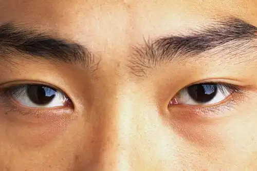 你真肾虚了吗这部位发黑才是真的肾虚