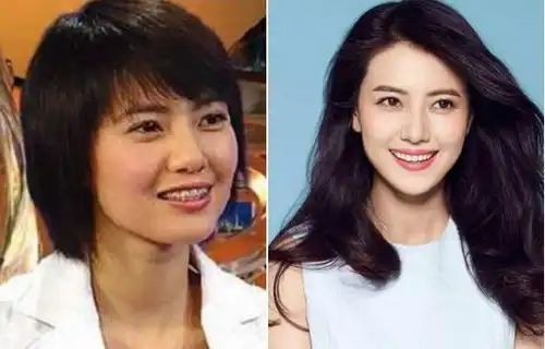 被誉为宝藏级颜值女星,被扒出整形前凸嘴眯眯眼还没下巴