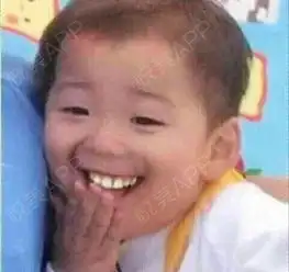 今天是一个非常重要的日子,因为今天要拆线啦但是由...瘦大腿悦美整形