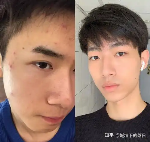 男生皮肤太油怎么办有没有好的男士控油护肤品推荐