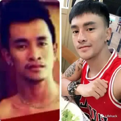 因太丑找不到工作,小伙整成了韩国男星脸
