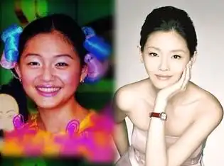 图揭林允儿整容前后对比照赵丽颖angelababy杨幂整容前后差好大