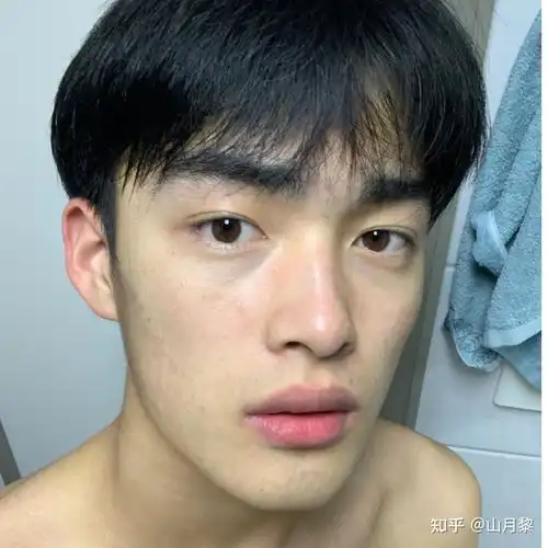 男生皮肤黑毛孔粗油痘肌,什么护肤品可以一次性解决