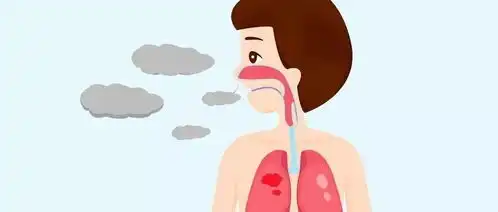 冬季咽喉疾病高发教您轻松保护咽喉